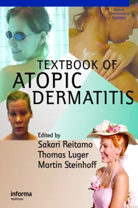 Textbook of Atopic Dermatitis_cover