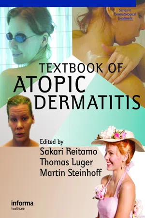 Textbook of Atopic Dermatitis