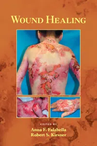 Wound Healing_cover