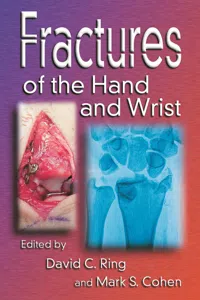 Fractures of the Hand and Wrist_cover