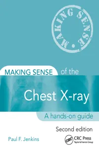 Making Sense of the Chest X-ray_cover