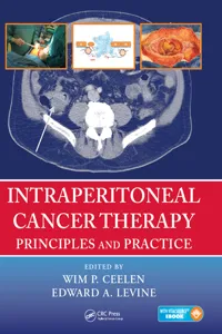 Intraperitoneal Cancer Therapy_cover