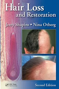 Hair Loss and Restoration_cover