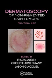 Dermatoscopy of Non-Pigmented Skin Tumors_cover
