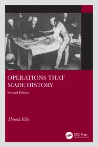 Operations that made History 2e_cover