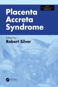 Placenta Accreta Syndrome_cover