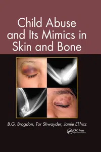 Child Abuse and its Mimics in Skin and Bone_cover