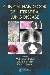 Clinical Handbook of Interstitial Lung Disease_cover