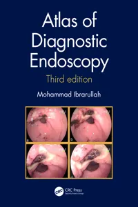 Atlas of Diagnostic Endoscopy, 3E_cover