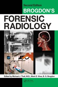 Brogdon's Forensic Radiology_cover