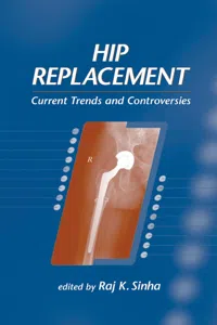 Hip Replacement_cover