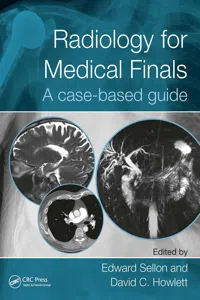 Radiology for Medical Finals_cover