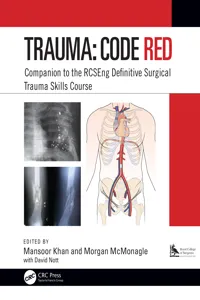 Trauma: Code Red_cover