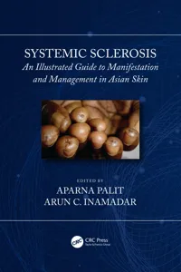 Systemic Sclerosis_cover