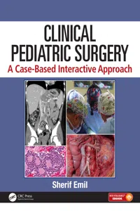 Clinical Pediatric Surgery_cover