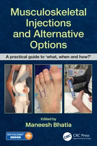 Musculoskeletal Injections and Alternative Options_cover