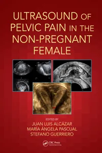 Ultrasound of Pelvic Pain in the Non-Pregnant Patient_cover
