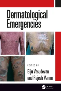 Dermatological Emergencies_cover
