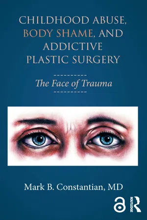 Childhood Abuse, Body Shame, and Addictive Plastic Surgery