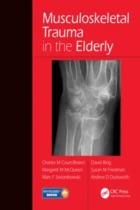 Musculoskeletal Trauma in the Elderly_cover