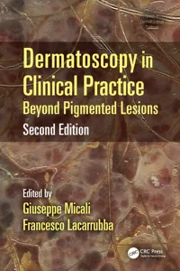 Dermatoscopy in Clinical Practice_cover