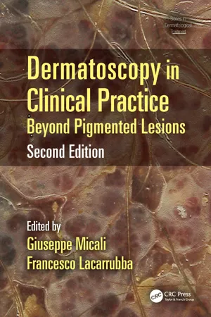 Dermatoscopy in Clinical Practice