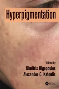 Hyperpigmentation_cover