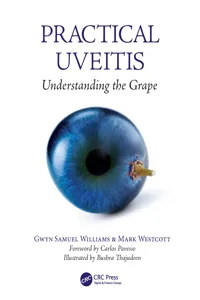 Practical Uveitis_cover