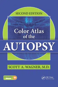 Color Atlas of the Autopsy_cover