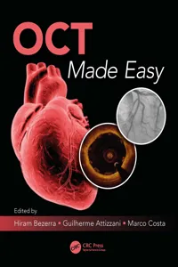 OCT Made Easy_cover