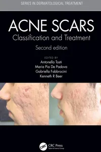 Acne Scars_cover