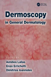 Dermoscopy in General Dermatology_cover