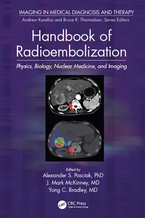 Handbook of Radioembolization