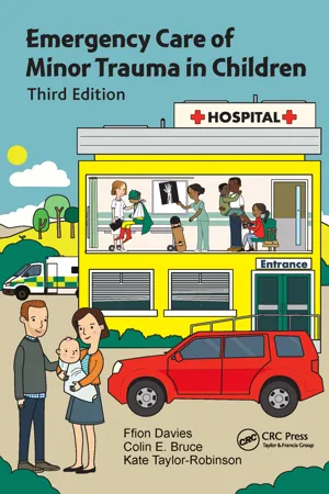 Emergency Care of Minor Trauma in Children