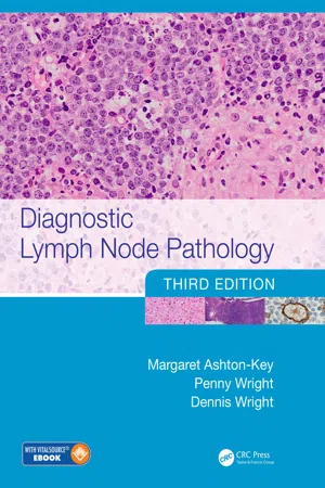 Diagnostic Lymph Node Pathology