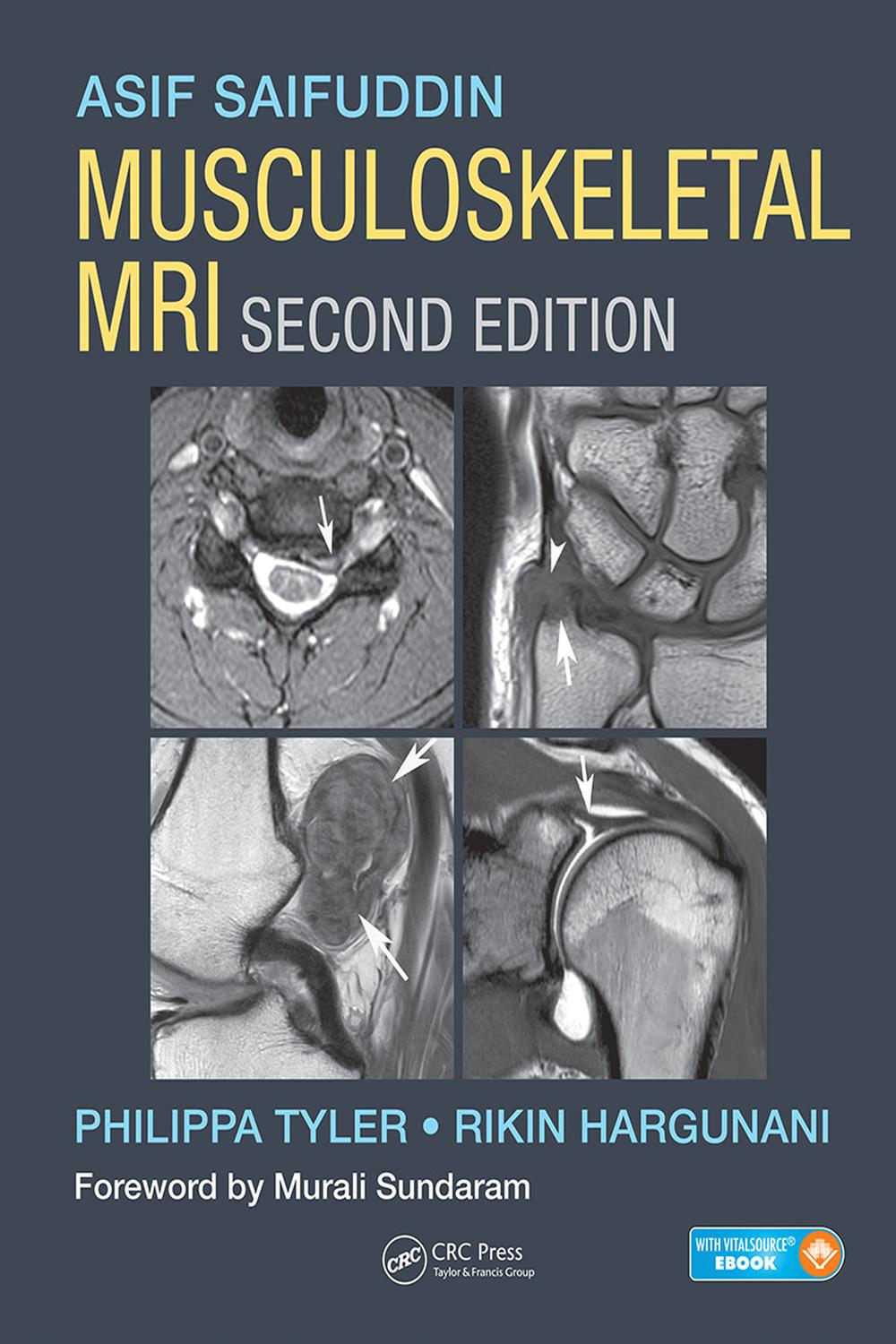 PDF] Musculoskeletal MRI by Asif Saifuddin, 2nd edition