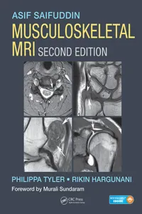 Musculoskeletal MRI_cover