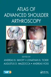 Atlas of Advanced Shoulder Arthroscopy_cover