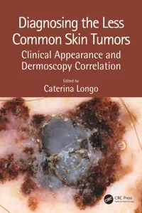Diagnosing the Less Common Skin Tumors_cover