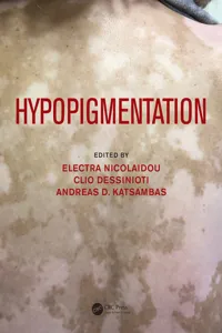 Hypopigmentation_cover