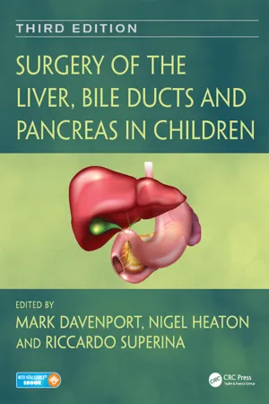 Surgery of the Liver, Bile Ducts and Pancreas in Children