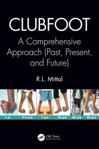 Clubfoot_cover