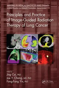 Principles and Practice of Image-Guided Radiation Therapy of Lung Cancer_cover