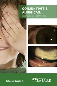 Conjuntivitis alérgicas_cover