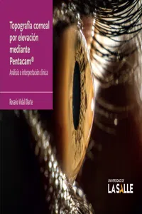 Topografía corneal por elevación mediante Pentacam®_cover