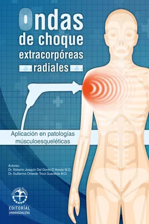 Ondas de choque extracorpóreas radiales: Aplicación en patologías músculo esqueléticas