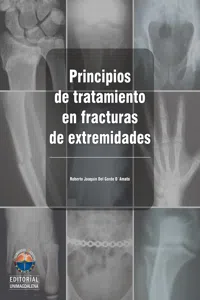 Principios de tratamiento en fracturas de extremidades_cover