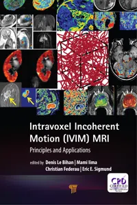 Intravoxel Incoherent Motion MRI_cover