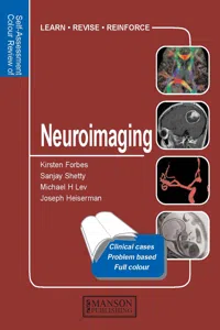 Neuroimaging_cover