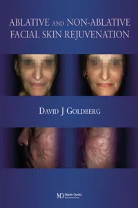 Ablative and Non-ablative Facial Skin Rejuvenation_cover